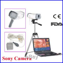 Fast Digital Vaginoscope Colposcope Color Sony Camera 480,000 pixels PC+ Stand